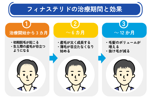 フィナステリドの治療期間と効果の目安を解説した図