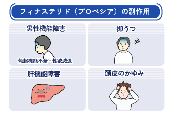 フィナステリド（プロペシア）の4つの副作用