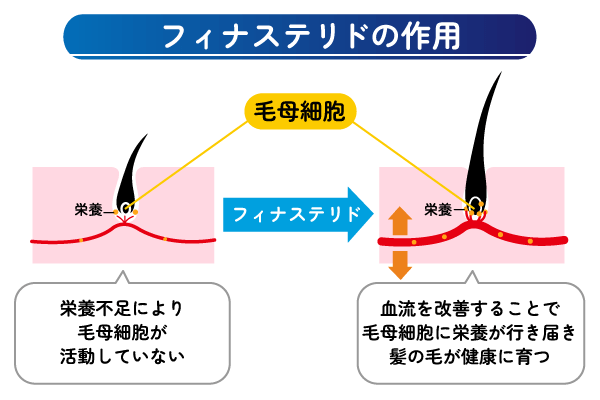 フィナステリドの効果・作用の図