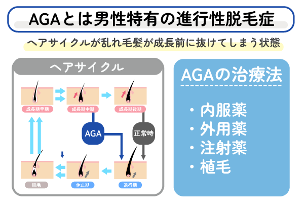 AGAとは?男性型脱毛症のことで4つの治療法がある