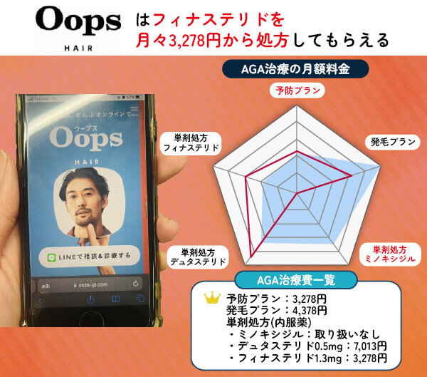 ウープスヘアのAGA治療スペック